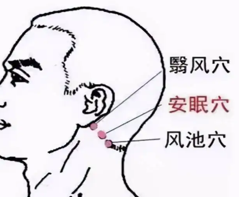 安眠穴穴在哪里，怎么艾灸针灸？