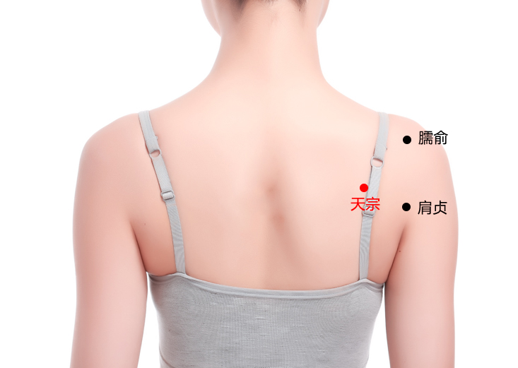 天宗穴在哪里，怎么艾灸针灸？一个穴位打败乳腺增生