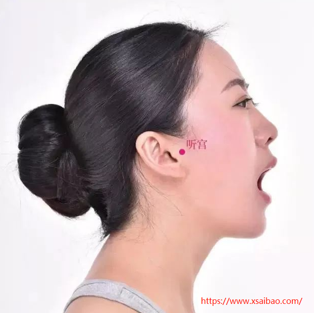听宫穴在哪里,怎么艾灸针灸?耳鸣、耳聋、齿痛 听宫穴在哪里,怎么艾灸针灸?耳鸣、耳聋、齿痛