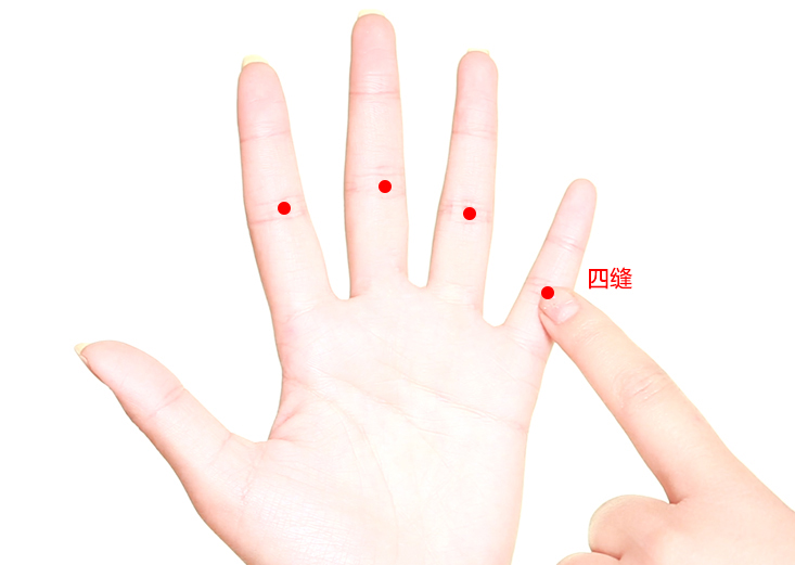 四缝穴位置作用与功效，各种疗法及注意事项