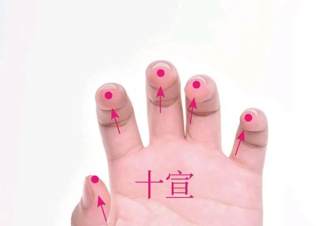 十宣穴位置作用与功效，各种疗法及注意事项
